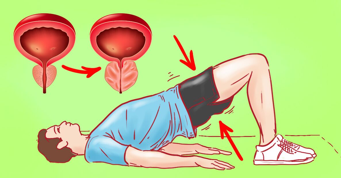 Gymnastikübungen gegen Prostatitis
